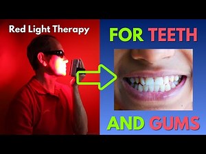 Your teeth will love it! Red light therapy for teeth and gums -with handheld therapy light Mito PRO
