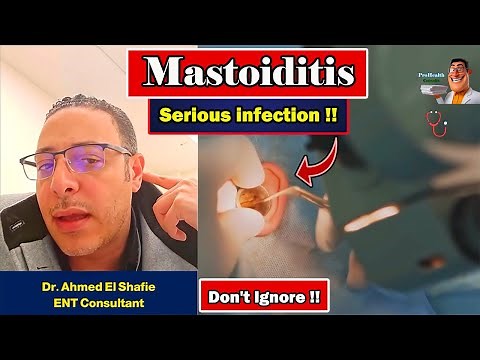 ⭐️Mastoiditis Dangers – When a Simple Ear Infection Turns Serious | ProHealthConsults