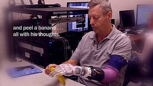 This Robotic Arm Inspired by Luke Skywalker Has Allowed an Amputee to Feel Again – Lifeboat News: The Blog