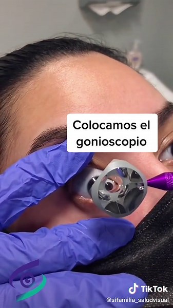 Evaluación del ángulo de drenaje ocular en oftalmología