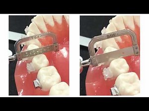 Automatic Strip (IPR Ststem) - World Bio Tech