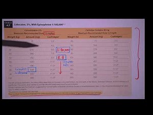 “Maximum Dosage of Local Anesthesia: Calculation Simplified” #Lidocaine 2% #adrenaline 1:80000