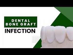 Dental Bone Graft Infection: 5 Causes You Should Look For