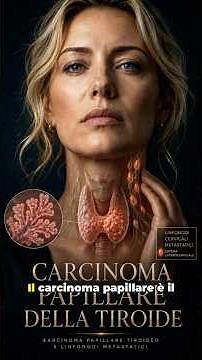 Carcinoma papillare della tiroide: sintomi, diagnosi e terapia