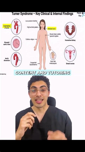 Turner Syndrome Made Easy | High-Yield USMLE Genetics Review