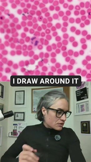 Neutrophils | Human Blood Under the Microscope