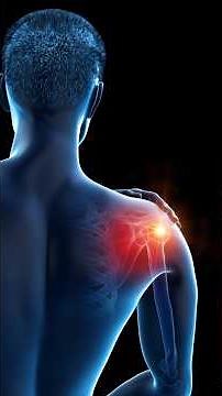 🔥 Shoulder Impingement? THIS Is the REAL Cause! 😱👇