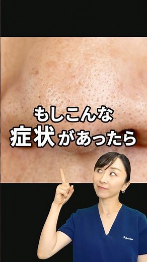 【もしこれがあったら】毛穴の黒ずみにおすすめの成分はこれ