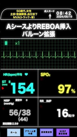 MVA(トラック×車)の重症外傷 #心電図 #看護師 #救急