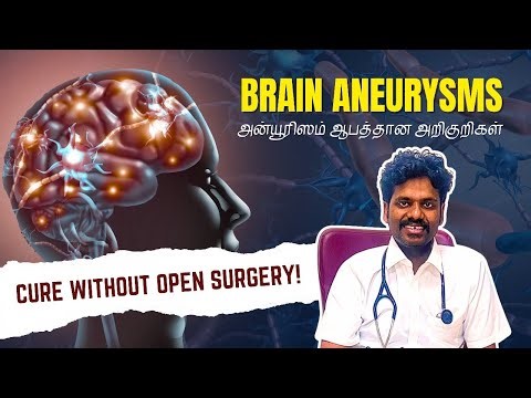 Brain Aneurysms Explained | Cure without Open Surgery- Aneurysm Coiling & Flow Diverters