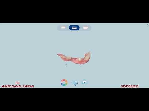 scanning usind dental scanner