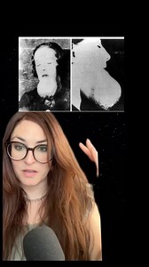 How does Radium destroy a human body? 🧪⌚️ PART 1 #truecrimecommunity #darkhistory #horrorstory #radium #radiumgirls | Rae Review