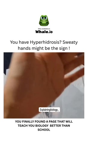 BIOLOGY | MEDICAL | HEALTH on Instagram: "A sweaty hands can be a sign of hyperhidrosis, a condition causing excessive sweating beyond normal levels due to triggers like heat or stress. Hyperhidrosis can be primary, meaning it appears on its own, often in youth, or secondary, caused by an underlying medical condition, medication, or anxiety. If excessive sweating disrupts your daily life or causes significant emotional distress, you should see a doctor to get a diagnosis and explore treatment op