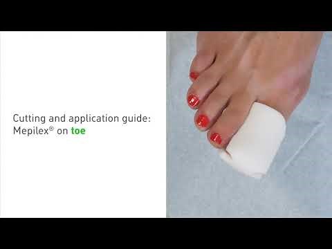 How to apply Mepilex on a toe