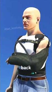 Broken Collarbone Treatment Explained (3D Animation)#ClavicleSurgery #CollarboneFracture