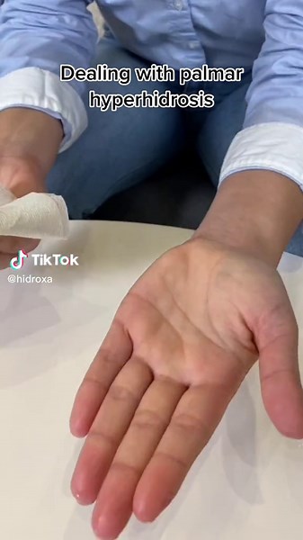 Understanding Palmar Hyperhidrosis Challenges