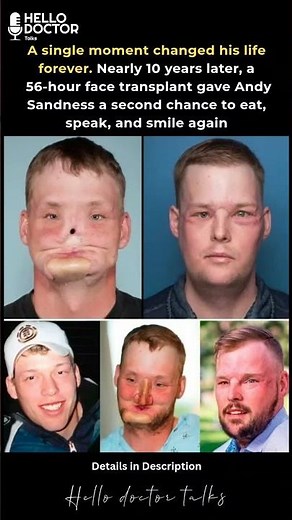 Nearly 10 years later, a 56-hour face transplant gave Andy Sandness a second chance