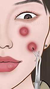 80K views · 432 reactions | ASMR treatment for bee sting swollen face P3 #asmr #asmranimation #satisfying #trending | Birdy ASMR | Facebook