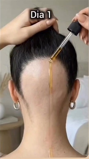 Just 15 Days! Hair Fall Will Be Gone & Hair Will Grow Shockingly Long 😱 | Rapid Hair Growth Oil