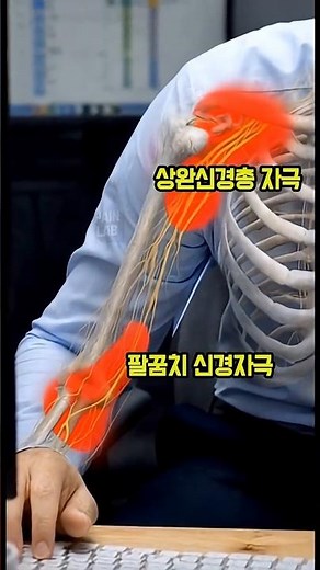 관절이 안좋은 이유