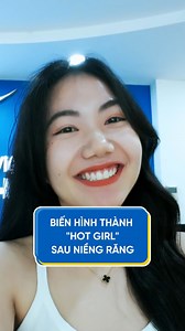 Khách hàng Lê Thị Liên lột xác thành hotgirl nhờ niềng răng #Xmatrix #niengrangXmatrix #nhakhoalacviet #lacvietintech #nhakhoauytin | Nha Khoa Lạc Việt Intech