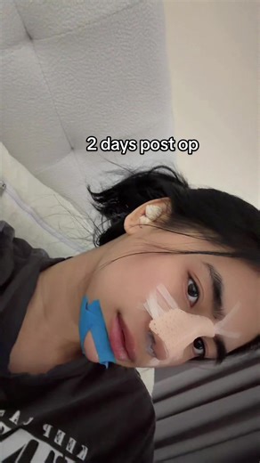 Happy Healing Post-Operation Tips