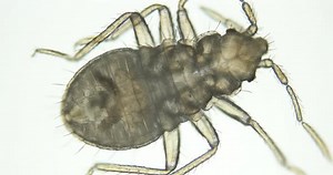 Bed Bug Nymph Cimex Lectularius Under a Microscope Order Hemiptera Family Cimicidae