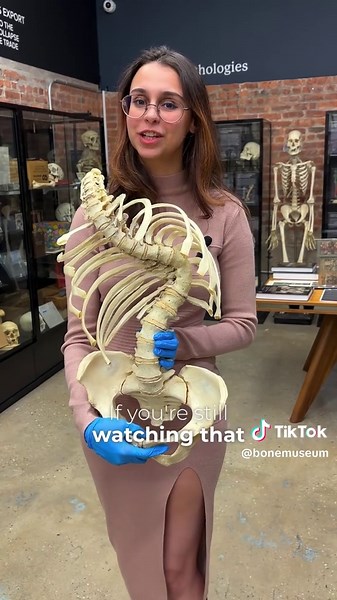 Step into a realm where history and science converge at The Bone Museum, located in the heart of Brooklyn, New York. Our latest video highlights some of our most captivating new additions: a fully fused human spine, a tibia with an amputation, Gordon (a fan-favorite fetal skeleton purchased from a doctor at NYU), a femur with gigantism, and many more. These, alongside countless other rare and unusual specimens, offer a powerful glimpse into the intricate stories bones can tell — from development