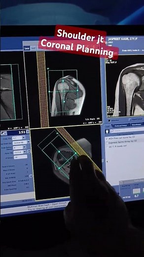 shoulder jt planning #mri shoulder