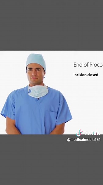 Kidner Procedure 3D Animation #kidnerprocedure #kidner #footsurgery #footsurgeryrecovery #medical3danimation #3dmedicalanimation #kidnersurgery