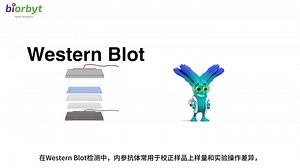 【Biorbyt实验专题】WB如何选择内参抗体
