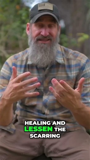 Suture Kits Have No Place in Wilderness Medicine