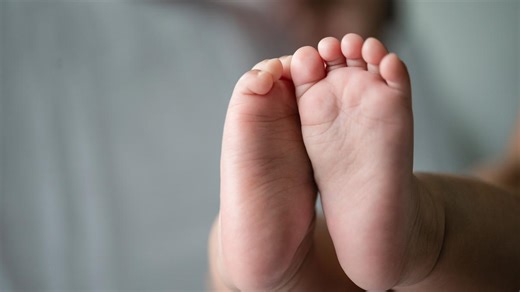 Congenital Talipes Equinovarus, Kelainan Bawaan yang Bisa Bikin Anak Sulit Berjalan