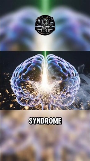 Alien Hand Syndrome #shorts #mystery #facts