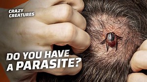 Parasites Explained: Creepy, Clever, and Everywhere