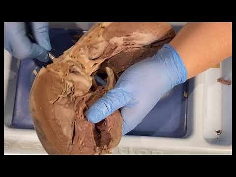 Internal Anatomy of the Mammalian Heart