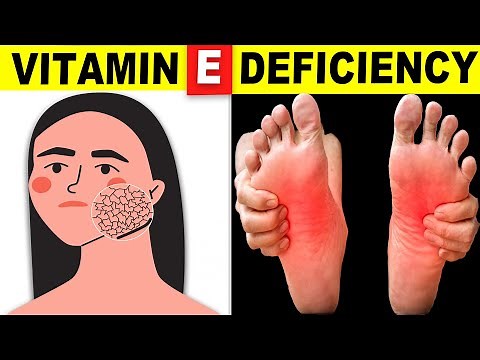 7 Signs Your Body Is Begging for Vitamin E