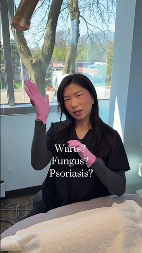 How to Get Rid of Warts, Fungus & Psoriasis