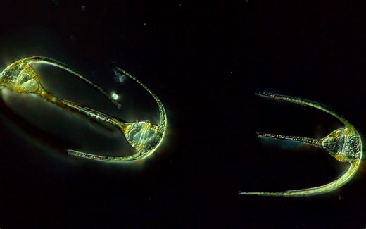 【浮游生物】角藻-纤纤素手为光而生_Ceratium-grow fingers to catch more light