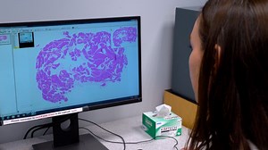 A Syngeneic Murine Model of Endometriosis using Naturally Cycling Mice