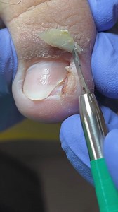 113K views · 951 reactions | #Pedicure | Nail Salon | Facebook