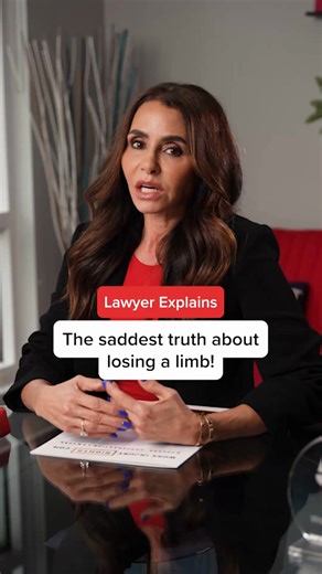 Losing a limb at work alters a life forever. 😔 From prosthetics to psychological support, we discuss what compensation really covers and the support that's still needed. #WorkInjuryRights #FloridaWorkersComp #MiamiWorkInjuryLawyer #InjuredWorkers #ProstheticsCare #MentalHealthSupport #PainAndSuffering #WorkersCompensation | WorkInjuryRights.com