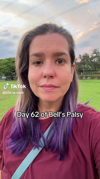 Day 62 of Bell’s Palsy. #bellspalsy #bellspalsyrecovery #fyp #onedayatatime #mentalhealthmatters