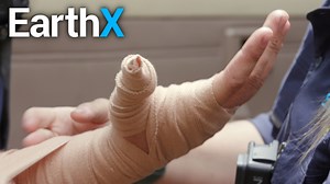 What To Do If You're Bitten By a Snake | Aussie Snake Wranglers | EarthX