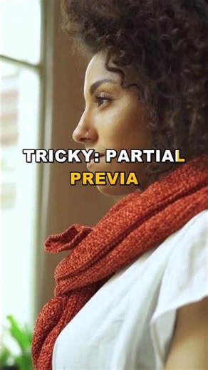 Placenta Previa: A Lifesaving Discovery