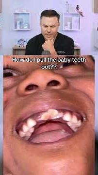 Can Your Baby Teeth Get STUCK?! 😮🦷