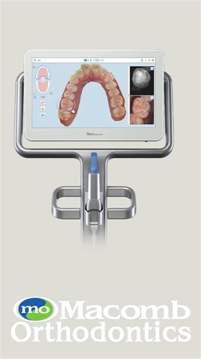 ✨ Fun Fact Friday ✨ Our iTero scanner doesn’t just scan — it simulates!  You can actually see what your smile will look like after orthodontic treatment… before you even get started! 彩 Now that’s some smile magic.  #FunFactFriday #FutureSmile #iTeroTechnology #MacombOrthodontics | Macomb Orthodontics | Facebook