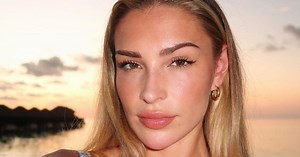 Inside Zara McDermott's dermatitis battle - as she tries and tests skincare