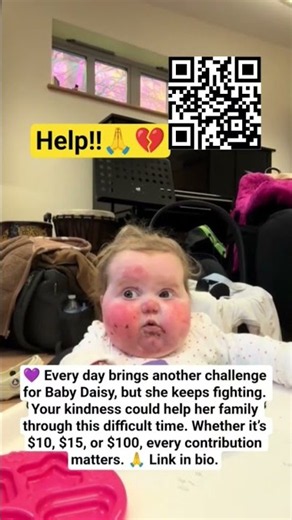 Every second counts. Please help Baby Daisy battle EB. A $20 or $50 donation helps