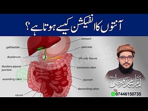 How Intestinal Infection Happens | Symptoms, Causes & Prevention Explained